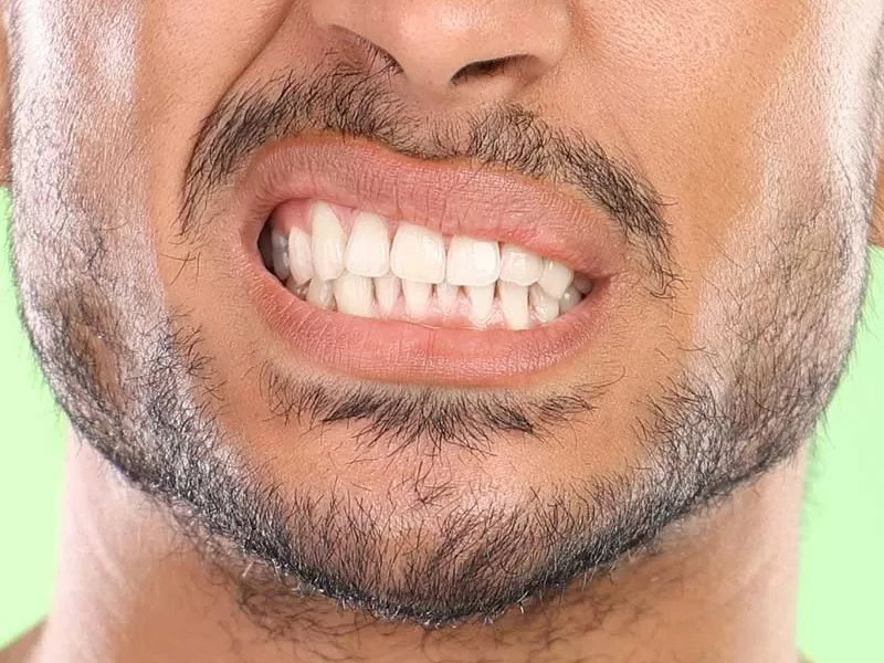 man-grinding-teeth